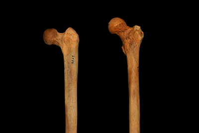 Photo of two left femurs