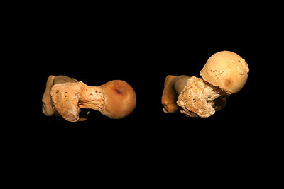 Photo looking down on two extremes of femoral torsion