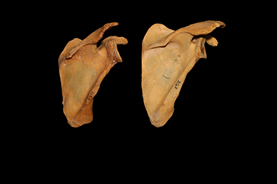 Photo of two right scapula from the back view