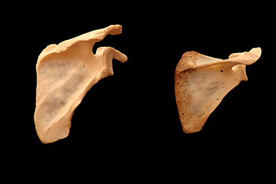 Photo of two right scapula