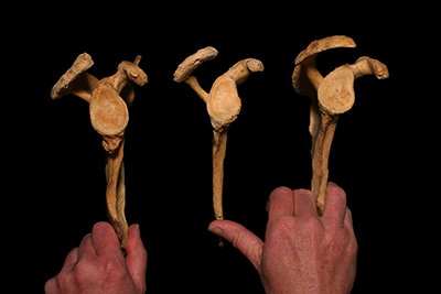 Photo of three right shoulder sockets of the scapula