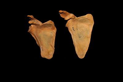 Photo of the ventral view of two right scapula