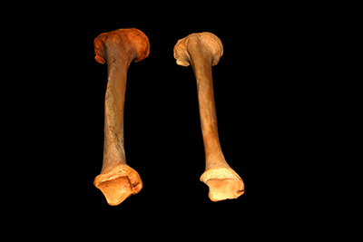 Photo of two right tibia